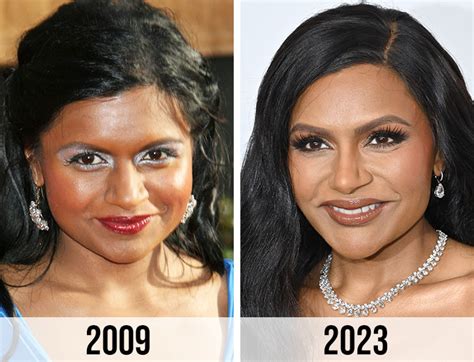 Mindy Kaling Plastic Surgery: The Truth Behind All Speculations